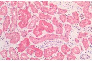 Immunohistochemistry analysis using Mouse Anti-HSP60 Monoclonal Antibody, Clone LK2 (ABIN2486568). (HSPD1 antibody  (PE))