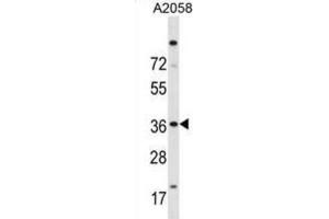 Western Blotting (WB) image for anti-ISL LIM Homeobox 2 (ISL2) antibody (ABIN2998805) (ISL2 antibody)