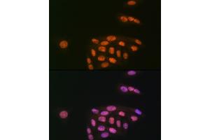 Immunofluorescence analysis of U-2 OS cells using K/MYST1/MOF Rabbit mAb (ABIN7268063) at dilution of 1:100 (40x lens). (MYST1 antibody)