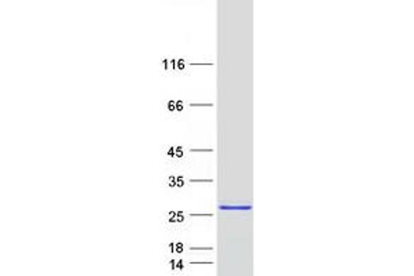 Proline Rich 15 Protein (PRR15) (Myc-DYKDDDDK Tag)