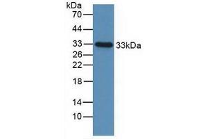 Figure. (IGFBP2 antibody  (AA 148-325))