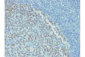 Formalin-fixed, paraffin-embedded human Tonsil stained with BCL-6 Mouse Recombinant Monoclonal Antibody (rBCL6/1718). (Recombinant BCL6 antibody  (AA 256-389))