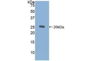 Detection of Recombinant CHRD, Mouse using Polyclonal Antibody to Chordin (CHRD) (Chordin antibody  (AA 422-635))