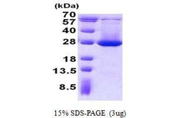 ADI1 Protein (His tag)