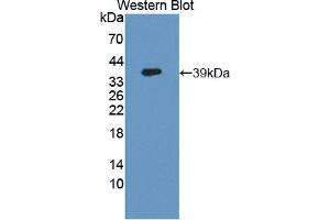 Western blot analysis of recombinant Human GCPII. (PSMA antibody  (AA 274-587))