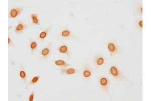 Immunocytochemistry analysis of ABIN7181464 diluted at 1:10 and staining in Hela cells(treated with 50nM Calyculin A for 30 min) performed on a Leica BondTM system. (Histone H1.5 antibody  (pThr137))