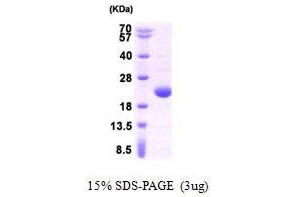 APRT Protein (AA 1-180)