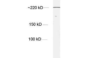 dilution: 1 : 1000, sample: NT2 cell lysate (Nestin antibody)