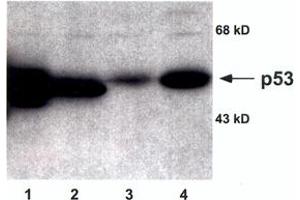 Image no. 1 for anti-Tumor Protein P53 (TP53) antibody (ABIN295785) (p53 antibody)