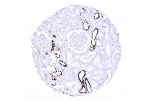 kidney cortex (Recombinant Cytokeratin 7 antibody  (AA 1-100))