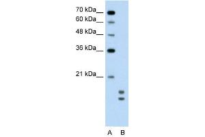 UBE2L3 antibody used at 0. (UBE2L3 antibody  (C-Term))