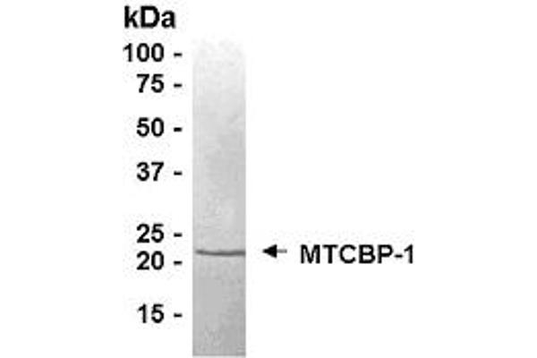 ADI1 Protein (AA 1-179)