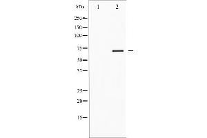 Western blot analysis of FKHR phosphorylation expression in EGF treated HeLa whole cell lysates (FOXO1 antibody  (pSer319))