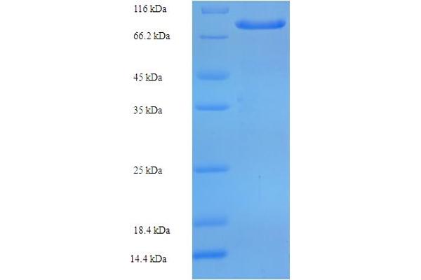 ARSG Protein (AA 17-525) (His-SUMO Tag)