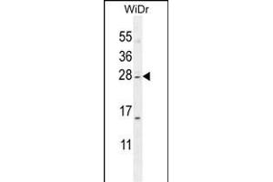 IQCF1 Antibody (N-term) (ABIN655458 and ABIN2844987) western blot analysis in WiDr cell line lysates (35 μg/lane). (IQCF1 antibody  (N-Term))