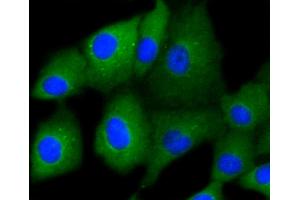 A549 cells were fixed in paraformaldehyde, permeabilized with 0. (Cytokeratin 7 antibody)