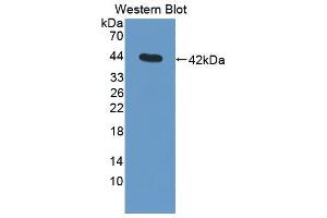 Western blot analysis of the recombinant protein. (C3 antibody  (AA 965-1303))