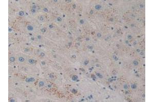 IHC-P analysis of Human Liver Tissue, with DAB staining. (CXCL12 antibody)