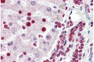 Human Liver (formalin-fixed, paraffin-embedded) stained with ANP32A antibody ABIN461886 at 5 ug/ml followed by biotinylated goat anti-rabbit IgG secondary antibody ABIN481713, alkaline phosphatase-streptavidin and chromogen. (PHAP1 antibody  (C-Term))