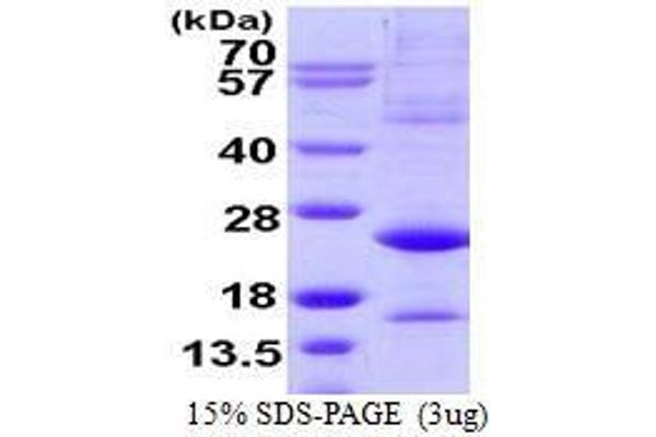 ATF3 Protein (AA 1-181)