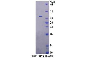 SDS-PAGE analysis of Mouse EEF1d Protein. (EEF1D Protein)