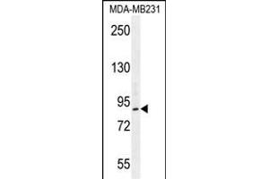 PCAF Antibody (N-term) (ABIN656012 and ABIN2845388) western blot analysis in MDA-M cell line lysates (35 μg/lane). (KAT2B antibody  (N-Term))