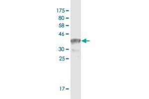 Western Blot detection against Immunogen (37. (TCF3 antibody  (AA 545-654))