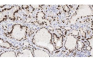 Human thyroid: immunohistochemical staining for Thyroid Transcription Factor-1. (NKX2-1 antibody  (N-Term))