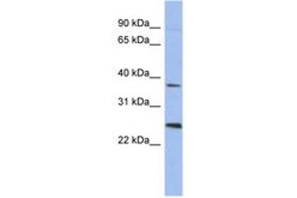 MAGEB2 antibody  (AA 71-120)