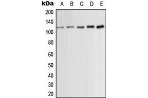 Western blot analysis of PKC mu (pS910) expression in HeLa (A), Jurkat (B), HEK293T PMA-treated (C), NIH3T3 PDGF-treated (D), H9C2 PMA-treated (E) whole cell lysates. (PKC mu antibody  (C-Term, pSer910))