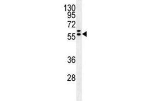 Glypican 3 antibody western blot analysis in HepG2 lysate (Glypican 3 antibody  (AA 21-50))