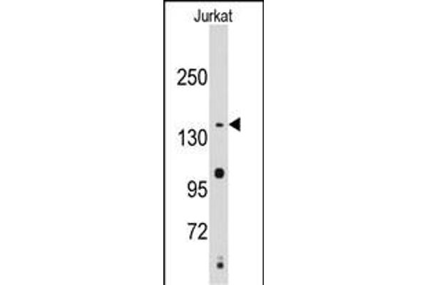 SMC2 antibody  (C-Term)