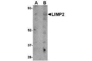 Image no. 1 for anti-Scavenger Receptor Class B, Member 2 (SCARB2) (C-Term) antibody (ABIN1493371) (SCARB2 antibody  (C-Term))