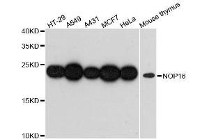 Western blot analysis of extracts of various cell lines, using NOP16 antibody. (NOP16 antibody  (AA 1-178))