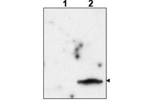 Image no. 1 for anti-FIV P24 Gag (Internal Region) antibody (ABIN401386) (FIV P24 Gag (Internal Region) antibody)