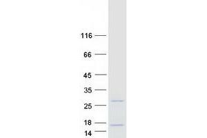 Validation with Western Blot (FKBP1B Protein (Transcript Variant 2) (Myc-DYKDDDDK Tag))