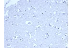 IHC analysis of formalin-fixed, paraffin-embedded human brain. (Recombinant p21 antibody  (AA 1-100))