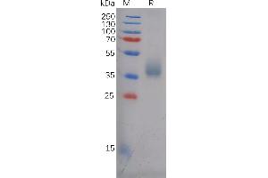 ANTXR1 Protein (AA 33-321) (His tag)