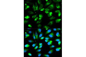 Immunofluorescence analysis of HeLa cells using ARHGDIA antibody. (ARHGDIA antibody)