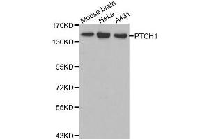 Western Blotting (WB) image for anti-Patched 1 (PTCH1) (AA 1214-1312) antibody (ABIN3015343) (Patched 1 antibody  (AA 1214-1312))