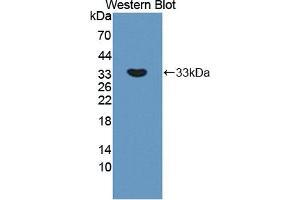 Figure. (APBA2 antibody  (AA 459-722))