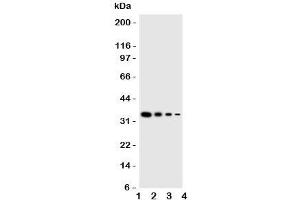 Western blot testing of GCN2 antbody;  Lane 1: Recombinant mouse protein 10ng;  2: 5ng;  3: 2. (GCN2 antibody  (Middle Region))