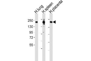 Western Blot at 1:2000 dilution Lane 1: human lung lysates Lane 2: human spleen lysates Lane 3: human placenta lysates Lysates/proteins at 20 ug per lane. (Macrophage Mannose Receptor 1 antibody  (N-Term))