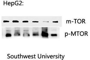 Western Blot (WB) analysis: Please contact us for more details. (MTOR antibody  (Ser394))