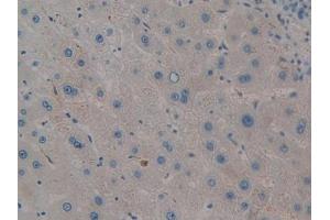 IHC-P analysis of Human Liver Tissue, with DAB staining. (PIM2 antibody  (AA 82-291))