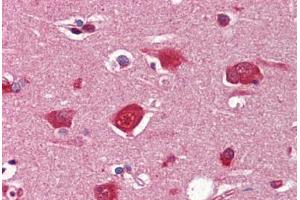 Human Brain, Cortex (formalin-fixed, paraffin-embedded) stained with Collagen I antibody ABIN462339 followed by biotinylated goat anti-rabbit IgG secondary antibody ABIN481713, alkaline phosphatase-streptavidin and chromogen. (Collagen Type I antibody)