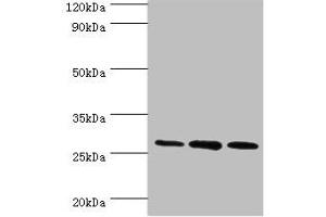 Western blot All lanes: ORC6 antibody at 16 μg/mL Lane 1: Mouse spleen tissue Lane 2: MCF-7 whole cell lysate Lane 3: Hela whole cell lysate Secondary Goat polyclonal to rabbit IgG at 1/10000 dilution Predicted band size: 28 kDa Observed band size: 28 kDa (ORC6 antibody  (AA 1-252))