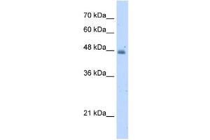 KYNU antibody used at 5 ug/ml to detect target protein. (KYNU antibody)