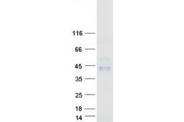 GGH Protein (Myc-DYKDDDDK Tag)