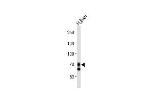 Western blot analysis of lysate from human liver tissue lysate, using SLCO1B1 Antibody (Center) (ABIN653562 and ABIN2842941). (SLCO1B1 antibody  (AA 267-293))